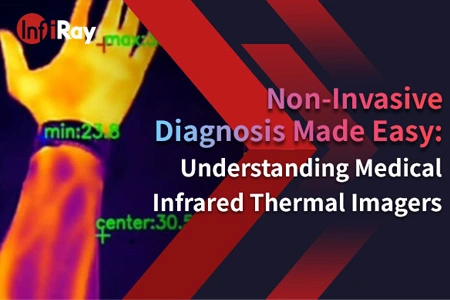Diagnóstico não invasivo facilitado: compreensão de imagens térmicas infravermelhas médicas